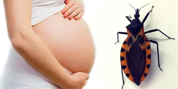 Día Mundial de la Enfermedad de Chagas 2026: una agenda global que pone a las mujeres en el centro
